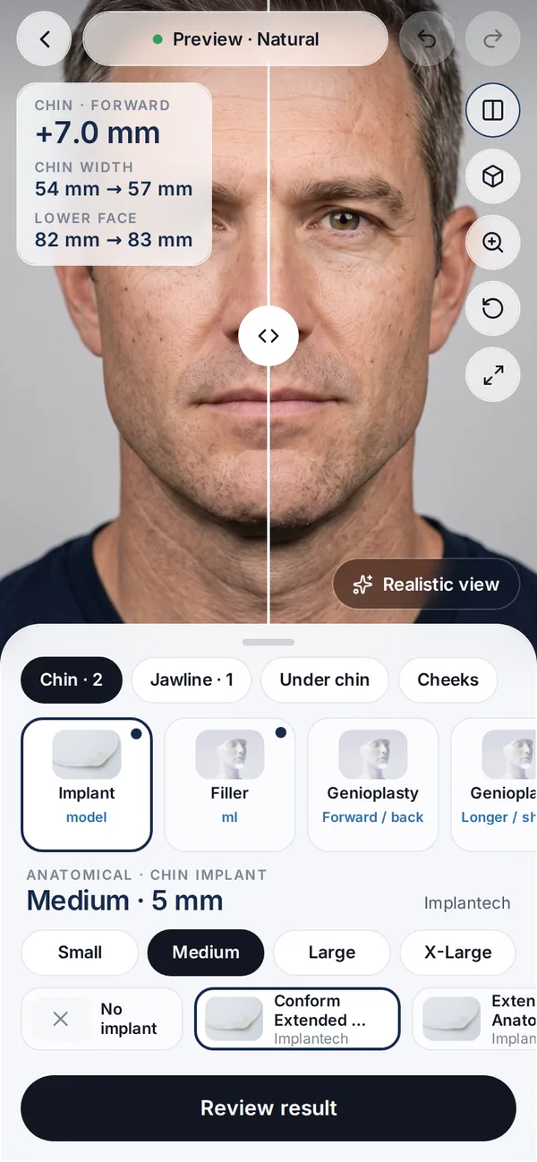 Veylo app screen: Set the treatment and the amount