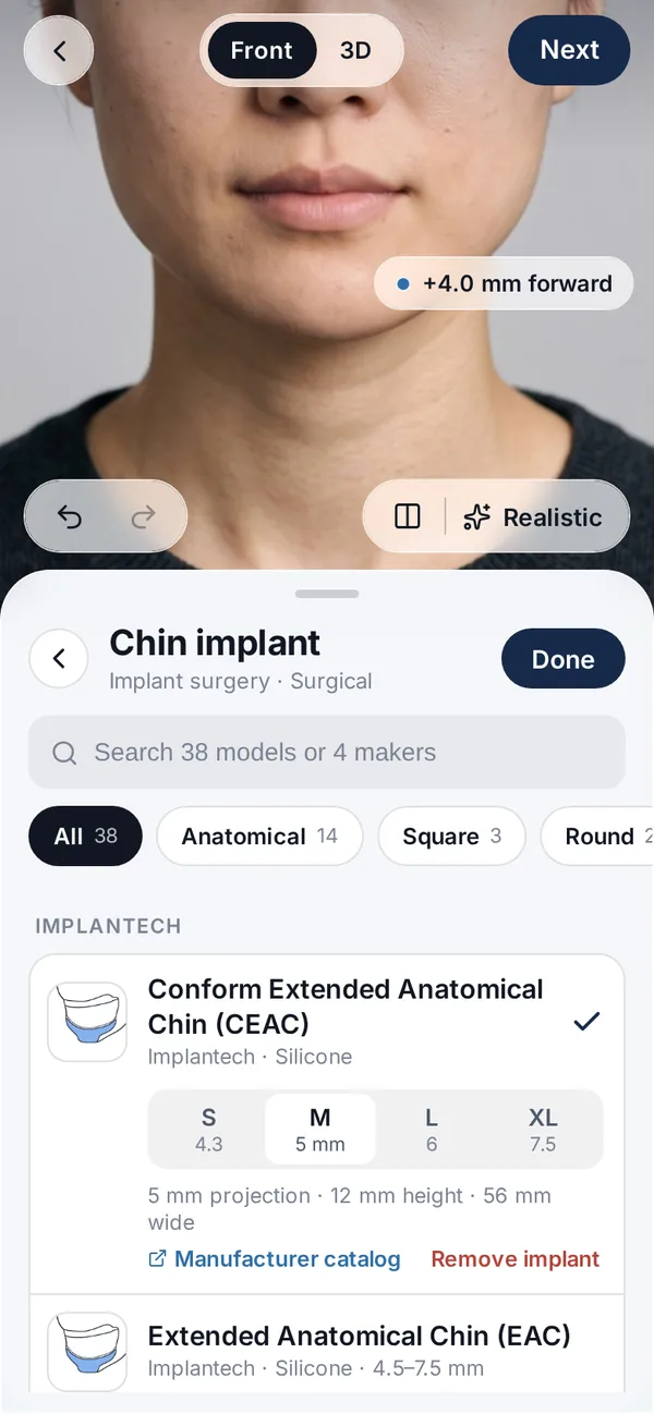 Veylo app screen with a synthetic face: Implant models and sizes