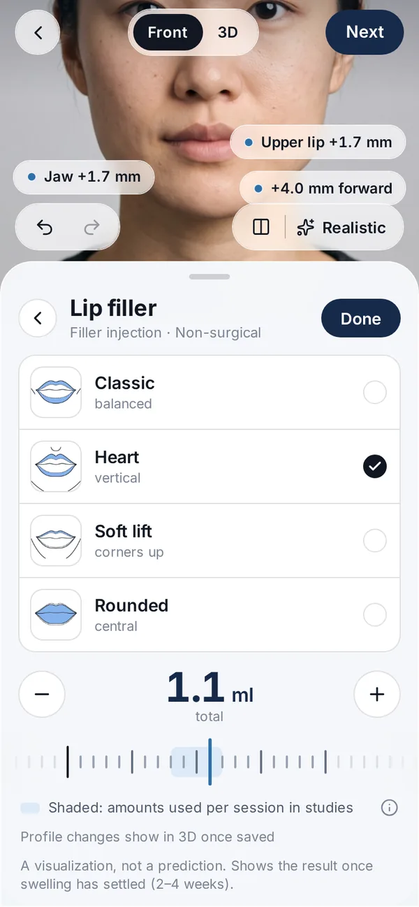 Veylo app screen with a synthetic face: Lip filler in ml, by style